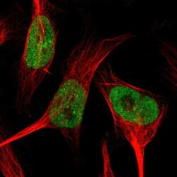 SMARCAD1 Antibody, Novus Biologicals 0.1mL; Unlabeled:Antibodies, Polyclonal